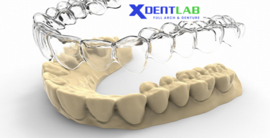 introduce Clear aligner supplier