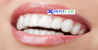 introduce Global contract manufacturing for clear aligners