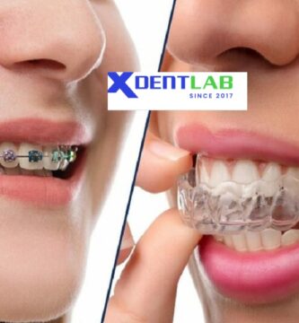 Aligner Companies in Vietnam
