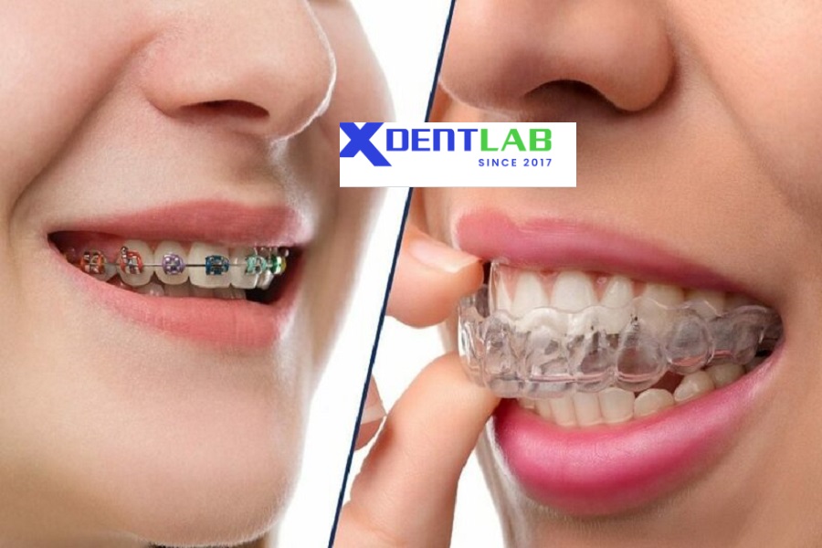 Aligner Companies in Vietnam