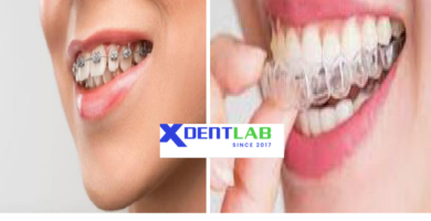 International orthodontic aligner production