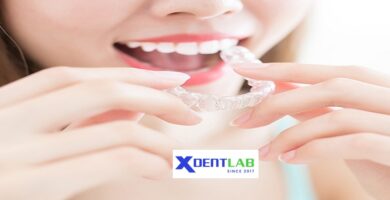 International orthodontic aligner production