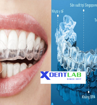 Introduce Worldwide clear aligner contract production