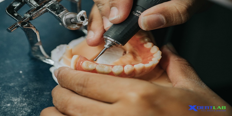 Vietnam Dental Laboratories District 6 Ho Chi Minh City