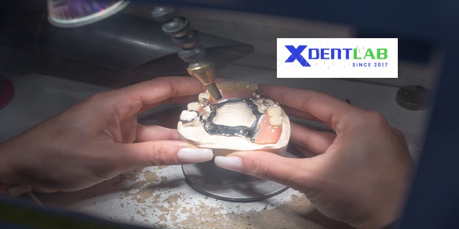 Vietnam dental laboratories